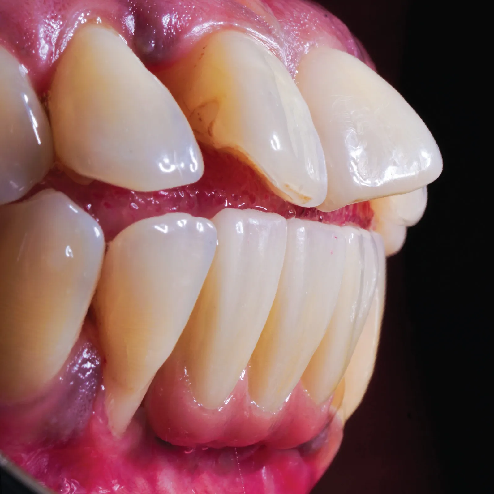 fotos-dental-implante-10_11zon