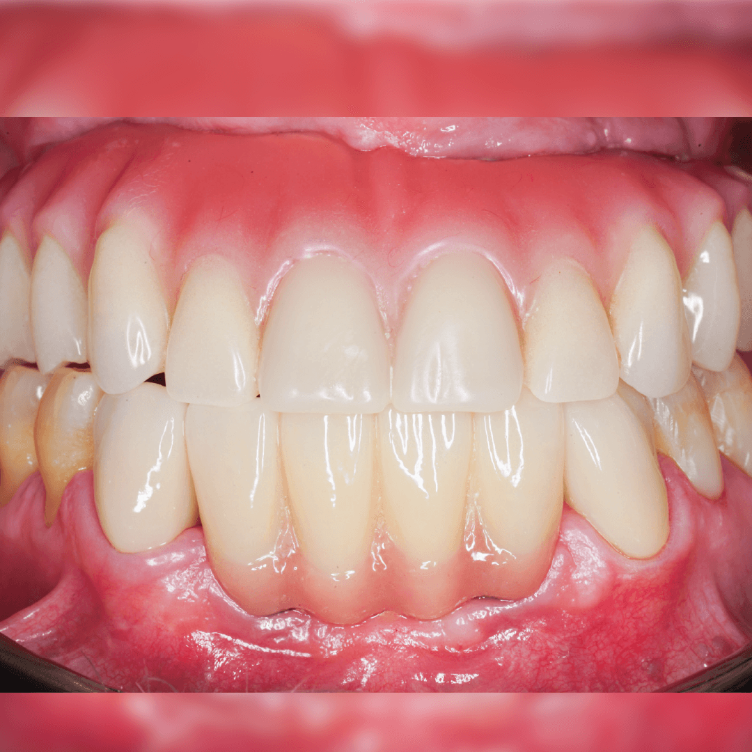 fotos-dental-ortodoncia-06