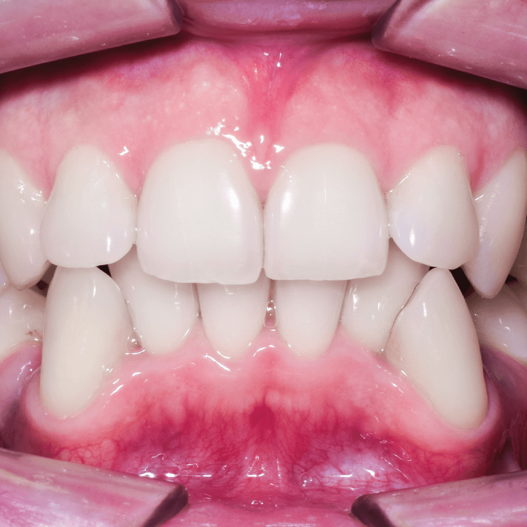 ortodoncia-nexus-dental-02