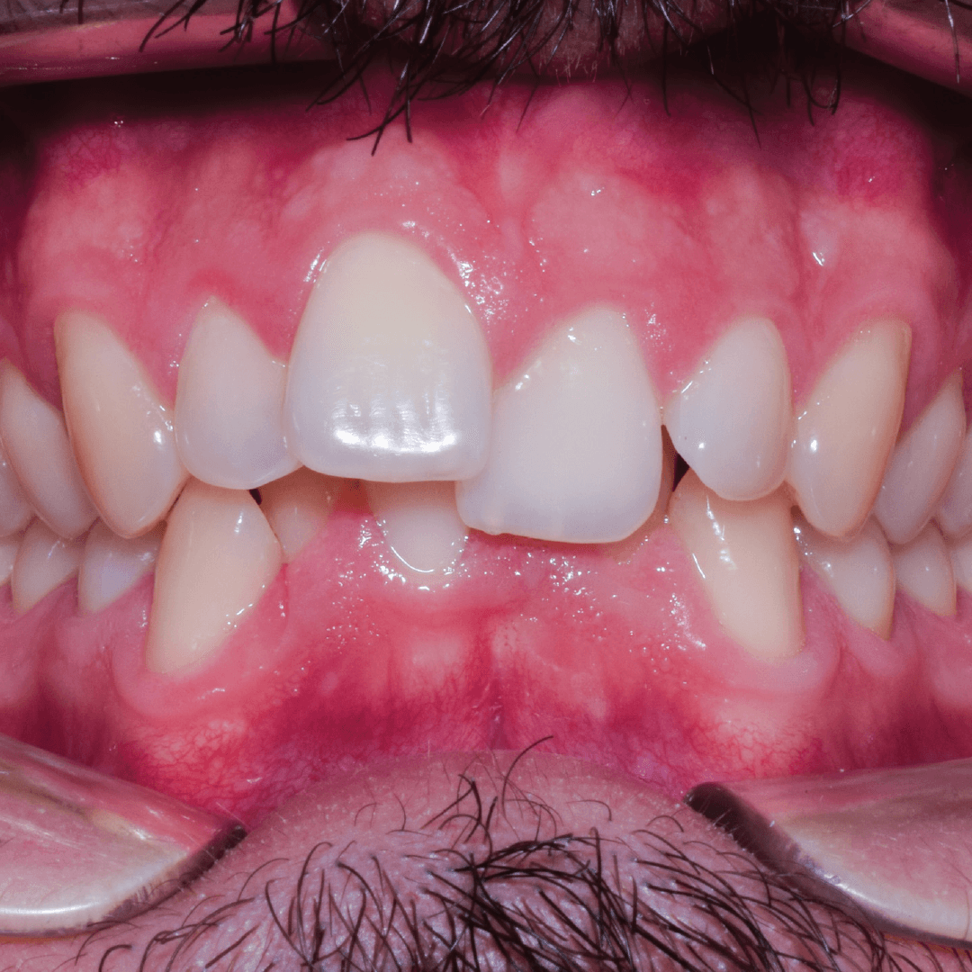 ortodoncia-nexus-dental-03