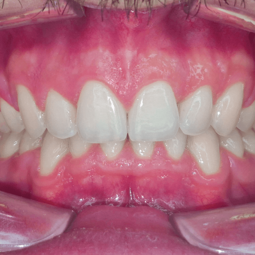 ortodoncia-nexus-dental-04