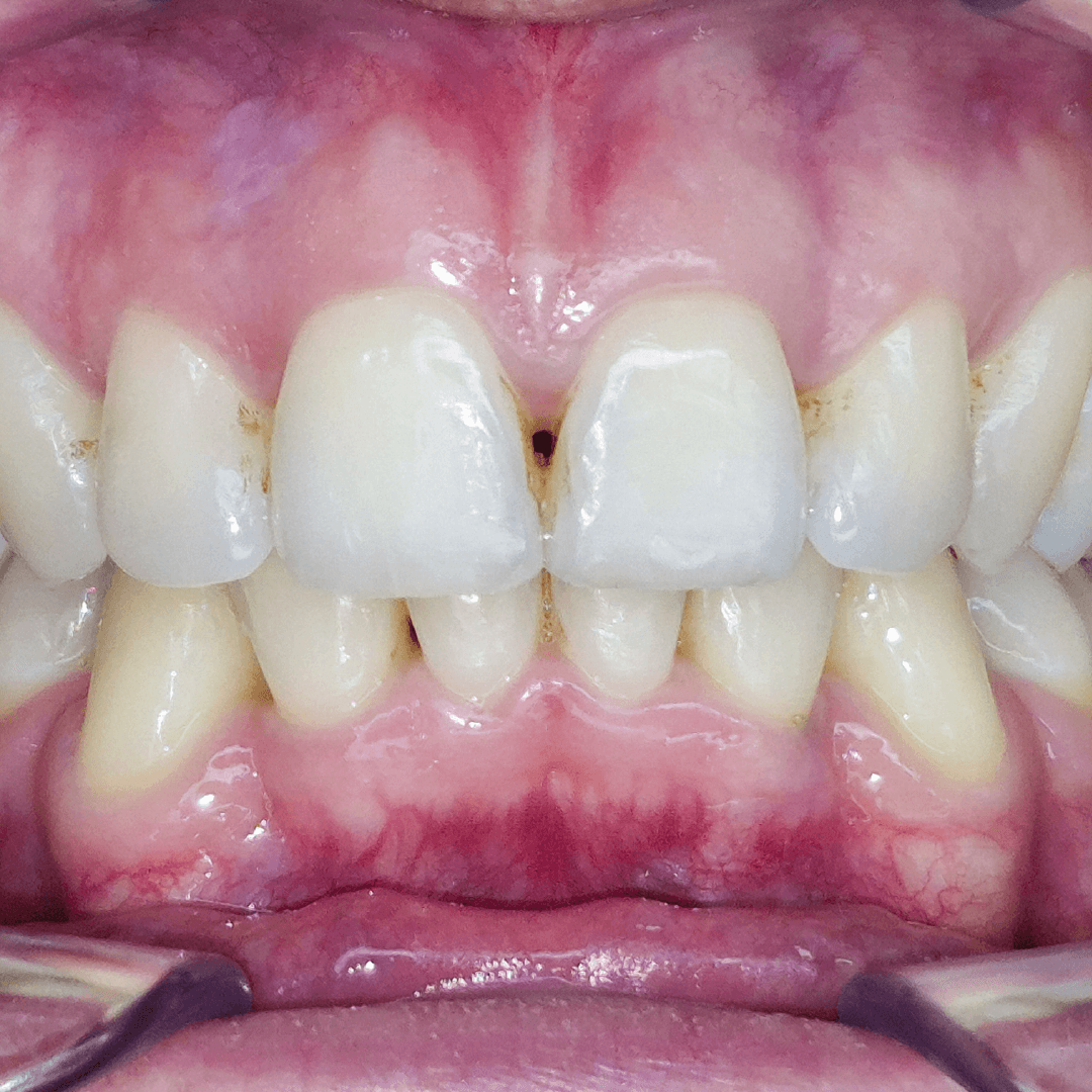 ortodoncia-nexus-dental_Mesa de trabajo 1